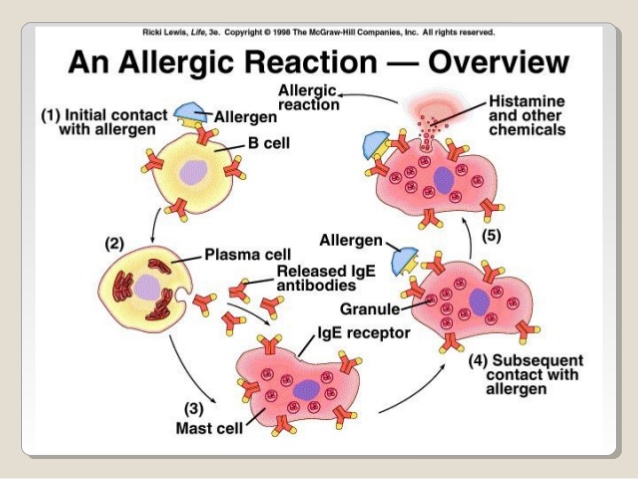 Bệnh mề đay cholinergic là gì? Cách điều trị