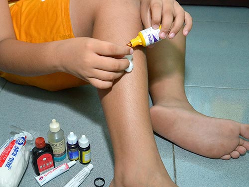 Cách chữa dị ứng da ở tay chân nhanh nhất