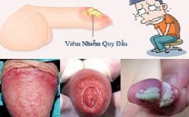 Nguyên nhân nổi mẩn ngứa ở vùng kín nam giới