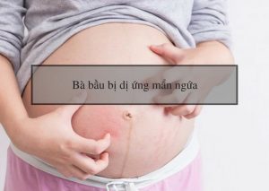 Bà bầu bị dị ứng mẩn ngứa khi mang thai phải làm sao