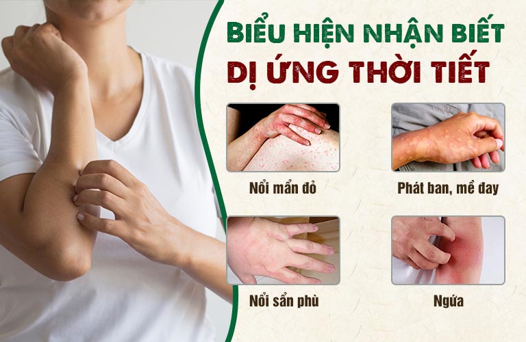 Biểu hiện dị ứng thời tiết thường gặp