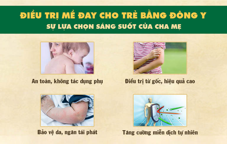 Chữa mề đay trẻ em bằng Y học cổ truyền mang lại nhiều ưu điểm