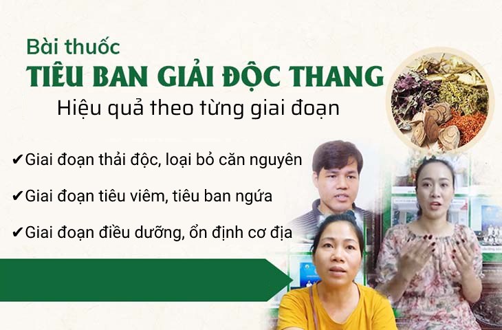 Bài thuốc Tiêu ban Giải độc thang hiệu quả với bệnh mề đay theo từng giai đoạn