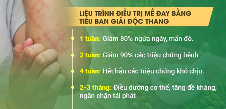 Chữa mề đay sau sinh