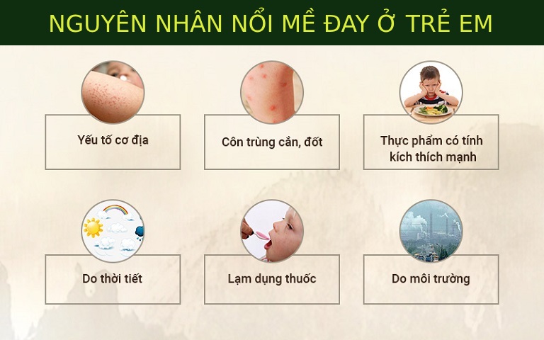 Nguyên nhân bé bị mề đay