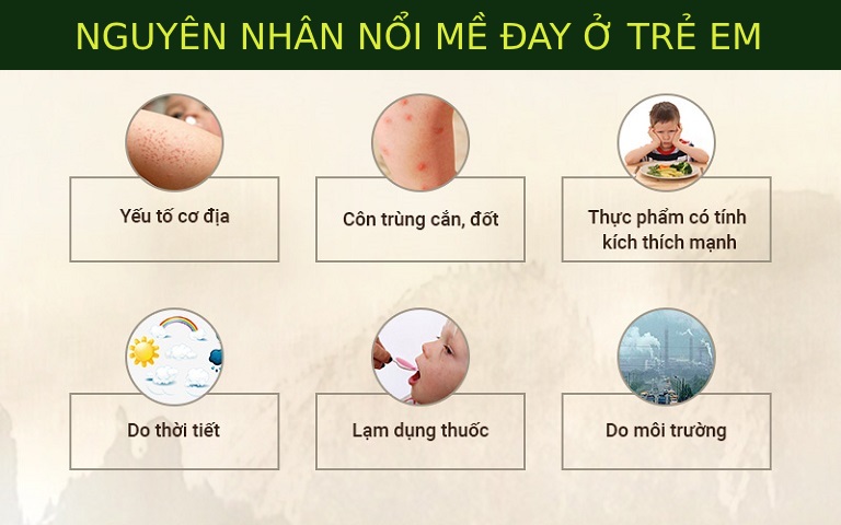 Nguyên nhân bé bị mề đay