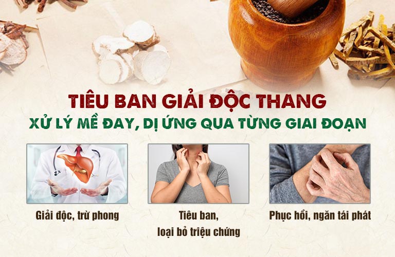 Tiêu ban Giải độc thang trị mề đay hiệu quả theo từng giai đoạn