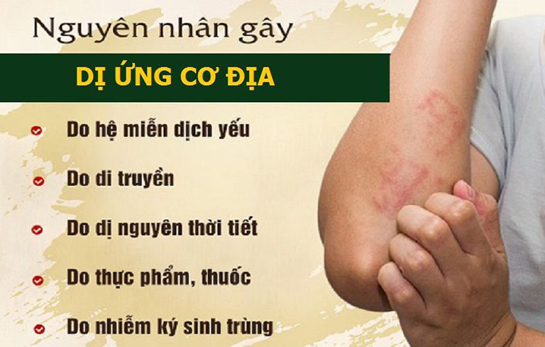 Nguyên nhân gây dị ứng cơ địa