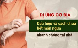 Dị ứng cơ địa