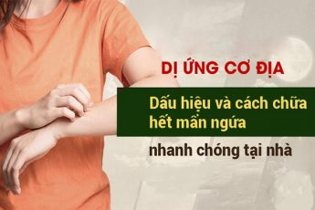 Dị ứng cơ địa