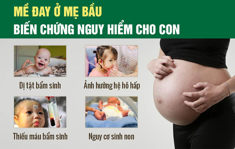 Mề đay khi mang thai có thể gây biến chứng nguy hiểm