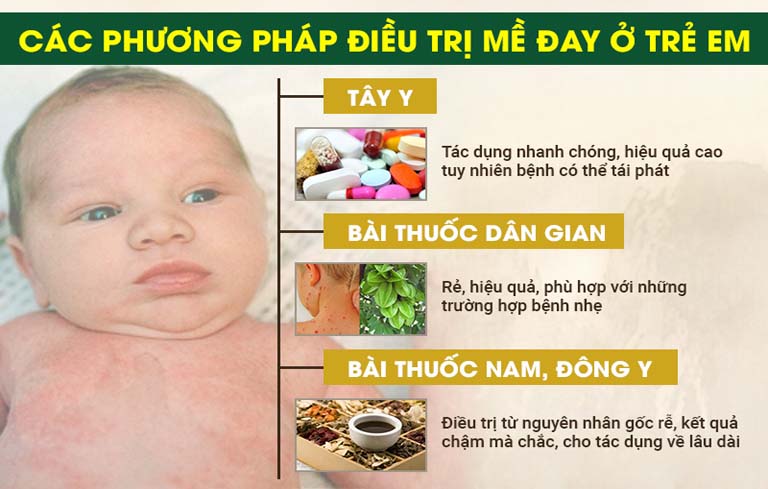 Các phương pháp điều trị mề đay ở trẻ em