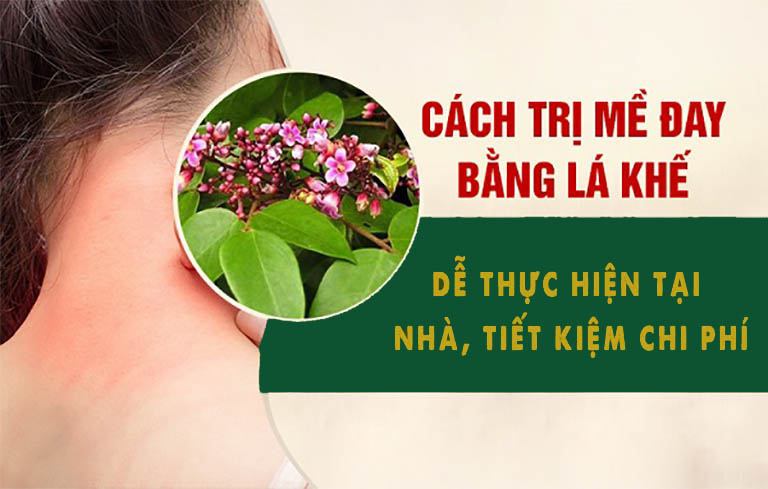 Sử dụng lá khế để tắm giúp giảm nhẹ triệu chứng