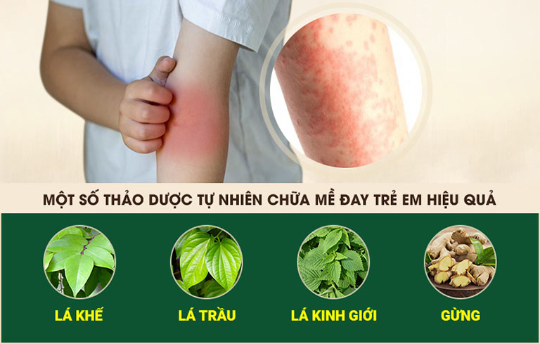 Mẹo dân gian dùng các thảo dược quen thuộc để chữa bệnh 