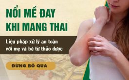 Bài thuốc Nam trứ danh giúp bà bầu đánh bại mề đay khi mang thai tại Trung tâm Thuốc dân tộc