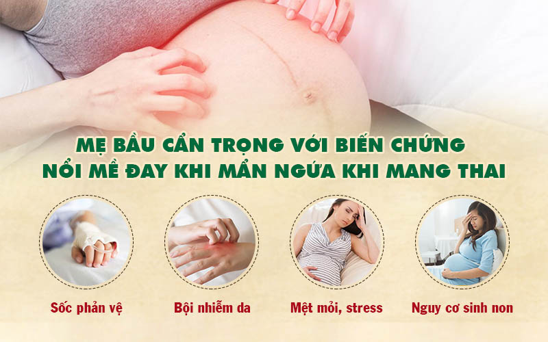 Nổi mề đay khi mang thai mẹ bầu có thể đối mặt với nhiều biến chứng