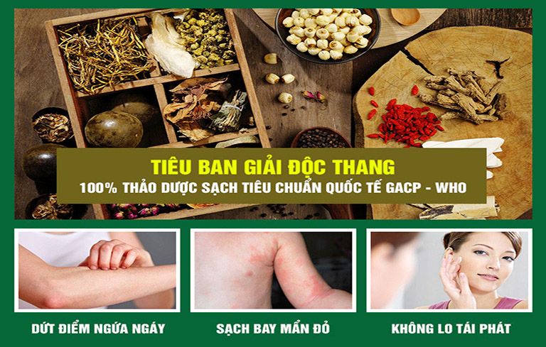 Tiêu ban giải độc thang là giải pháp chữa mề đay hiệu quả an toàn