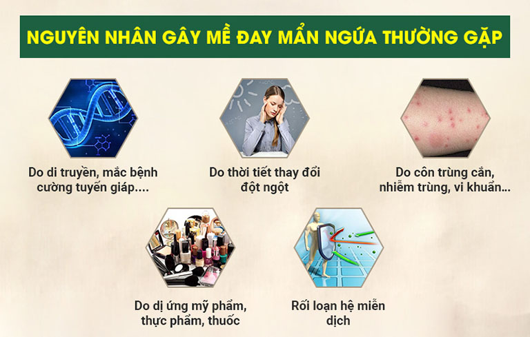 Nguyên nhân gây ra mề đay mẩn ngứa rất phức tạp