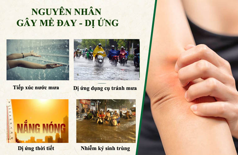 Nguyên nhân khiến nhiều người dân Miền Nam bị mề đay, dị ứng