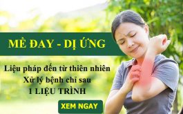 Liệu pháp xử lý mề đay, dị ứng từ gốc