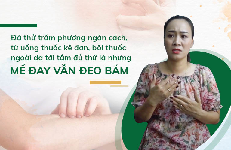 Mặc dù áp dụng nhiều cách nhưng mề đay vẫn thường xuyên tái phát