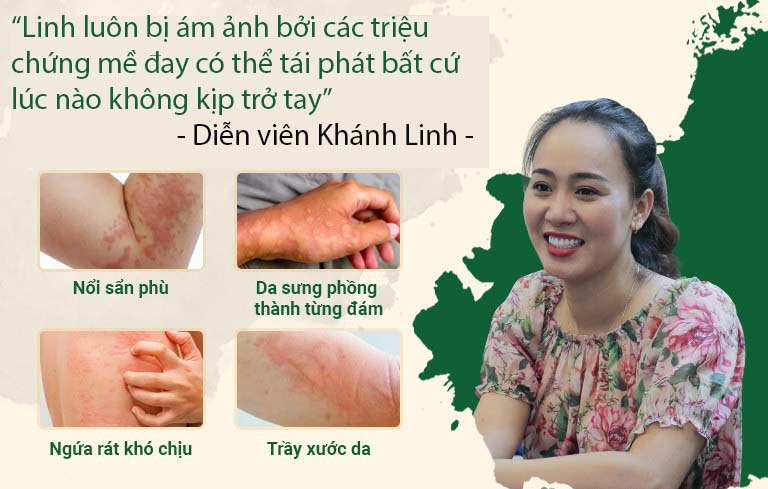 Diễn viên Khánh Linh luôn bị ám ảnh vì triệu chứng bệnh mề đay