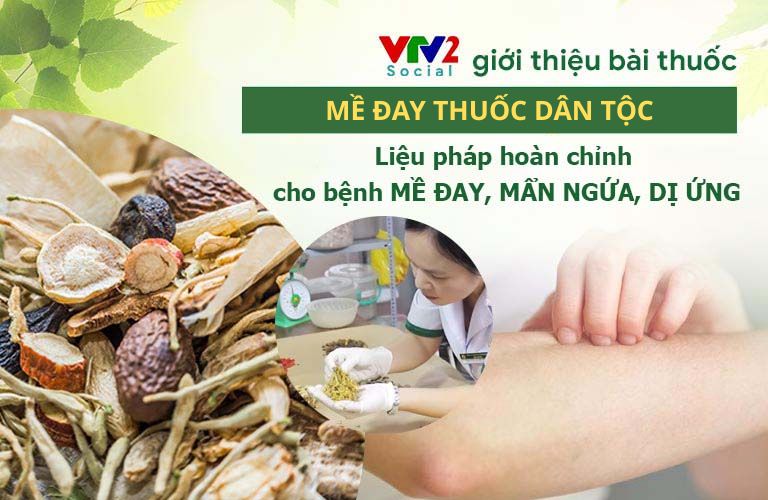 VTV2 Đưa Tin Cách Xử Lý Mề Đay Từ Thuốc Nam Giúp Nhiều Người Lành Bệnh