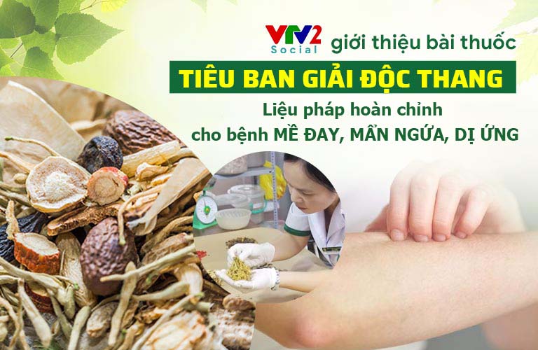 VTV2 giới thiệu bài thuốc Tiêu ban Giải độc thang đặc trị mề đay mẩn ngứa