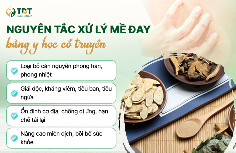 Nguyên tắc hỗ trợ điều trị mề đay từ y học cổ truyền